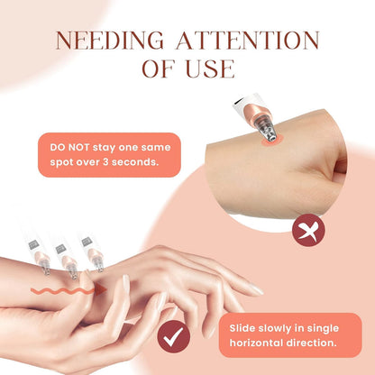 Electric blackhead remover