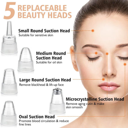 Electric blackhead remover