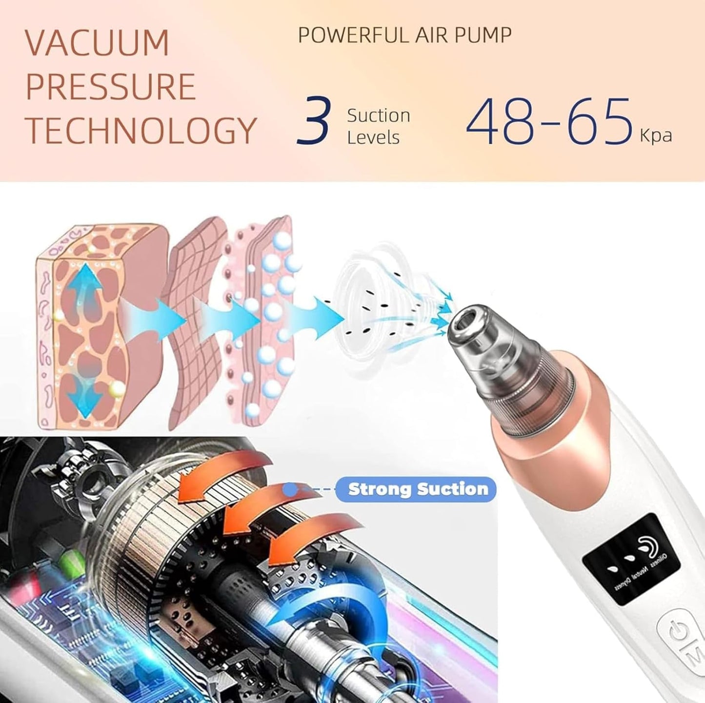 Electric blackhead remover