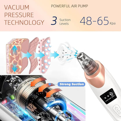 Electric blackhead remover