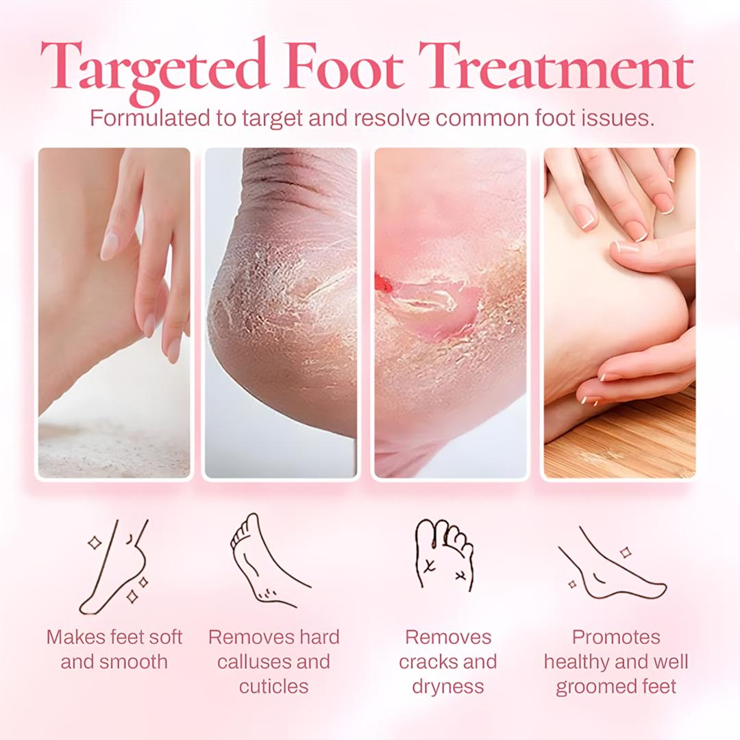 VelvetStep 5K Callus Remover