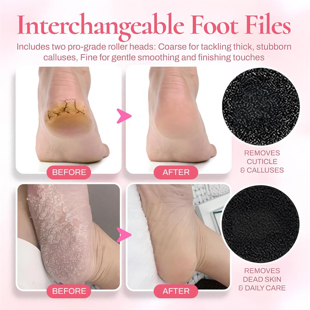 VelvetStep 5K Callus Remover