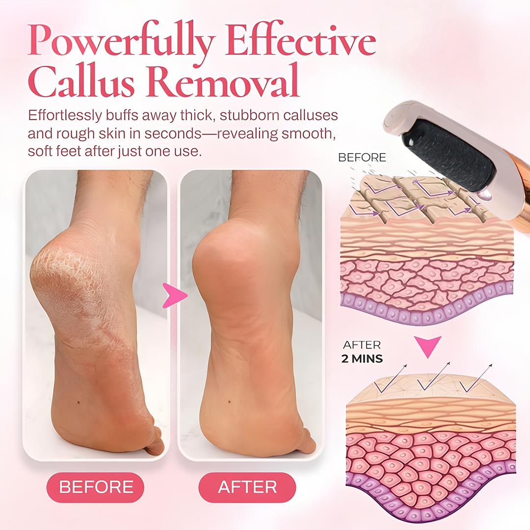 VelvetStep 5K Callus Remover