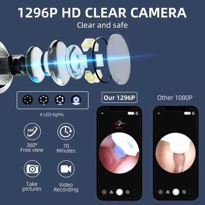 Smart Ear Wax Cleaner with Camera — See Inside While You Clean